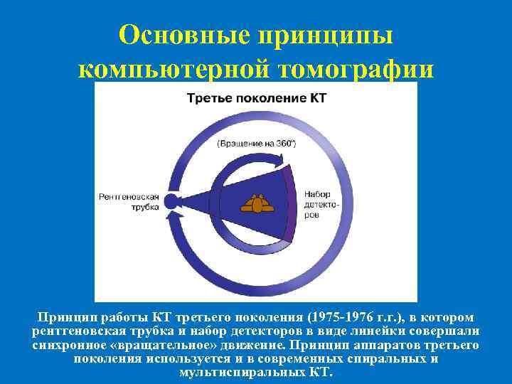 Основные принципы компьютерной томографии Принцип работы КТ третьего поколения (1975 -1976 г. г. ),