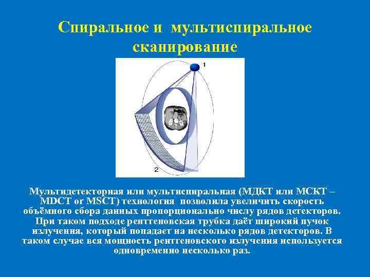 Спиральное и мультиспиральное сканирование Мультидетекторная или мультиспиральная (МДКТ или МСКТ – MDCT or MSCT)