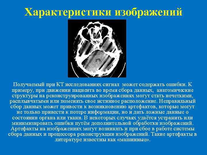Характеристики изображений Получаемый при КТ исследованиях сигнал может содержать ошибки. К примеру, при движении