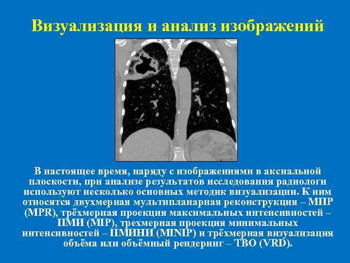 Визуализация и анализ изображений В настоящее время, наряду с изображениями в аксиальной плоскости, при