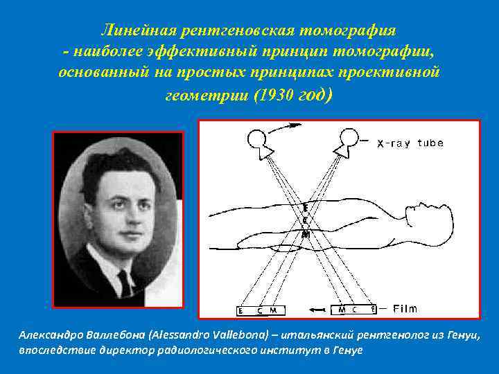 Принцип метода рентгеновской компьютерной томографии