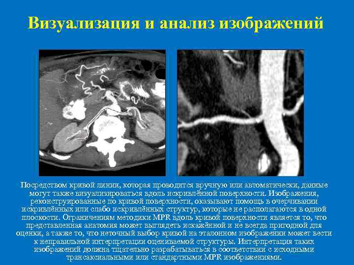 Визуализация и анализ изображений Посредством кривой линии, которая проводится вручную или автоматически, данные могут