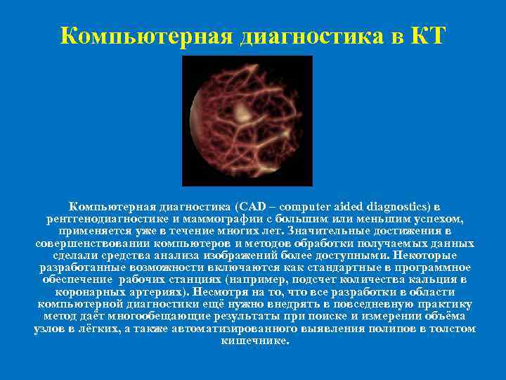 Компьютерная диагностика в КТ Компьютерная диагностика (CAD – computer aided diagnostics) в рентгенодиагностике и