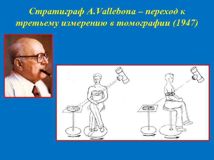 Стратиграф A. Vallebona – переход к третьему измерению в томографии (1947) 