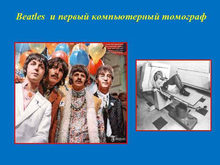 Beatles и первый компьютерный томограф 