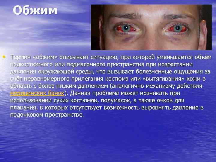 Обжим • Термин «обжим» описывает ситуацию, при которой уменьшается объём подкостюмного или подмасочного пространства