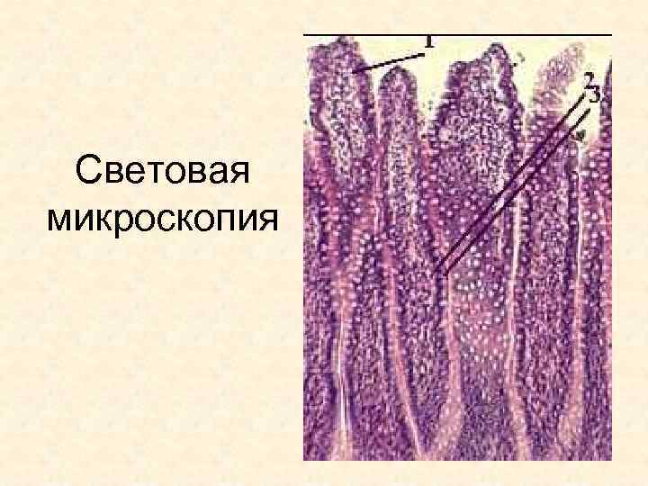 Световая микроскопия 