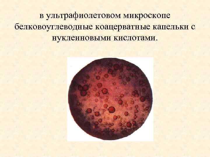 в ультрафиолетовом микроскопе белковоуглеводные коацерватные капельки с нуклеиновыми кислотами. 