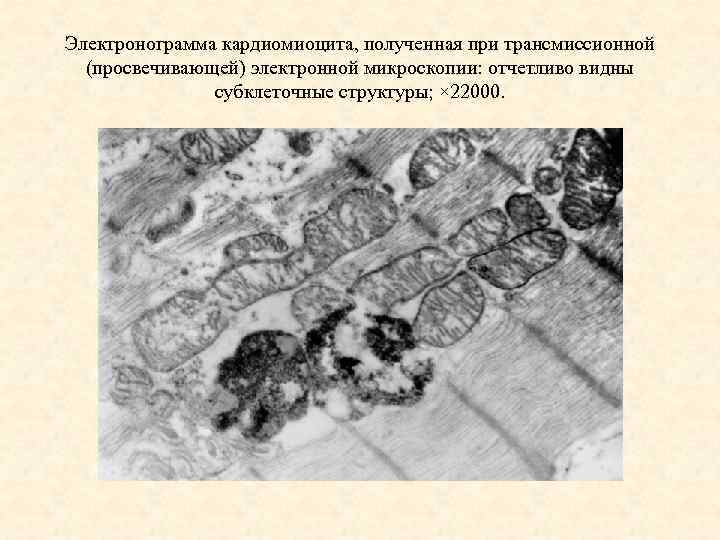 Электронограмма кардиомиоцита, полученная при трансмиссионной (просвечивающей) электронной микроскопии: отчетливо видны субклеточные структуры; × 22000.