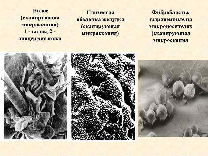 Волос (сканирующая микроскопия) 1 - волос, 2 эпидермис кожи Слизистая оболочка желудка (сканирующая микроскопия)