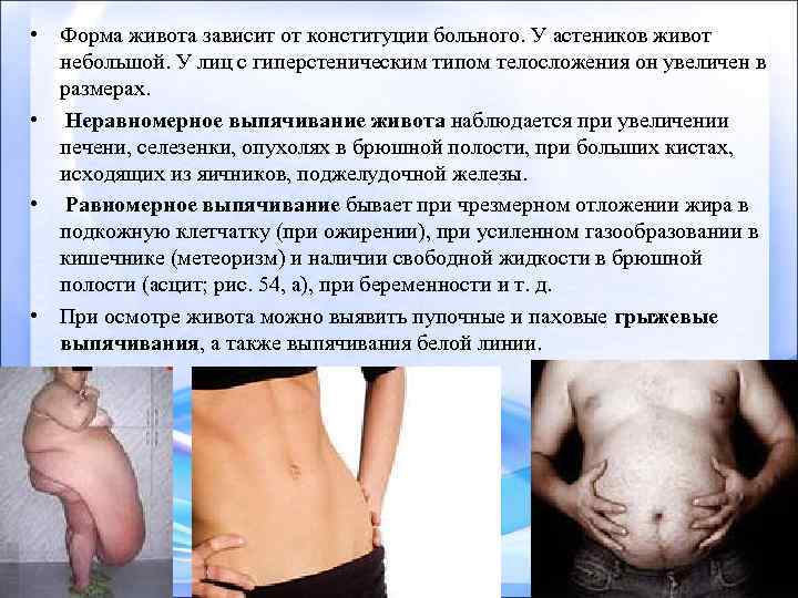  • Форма живота зависит от конституции больного. У астеников живот небольшой. У лиц