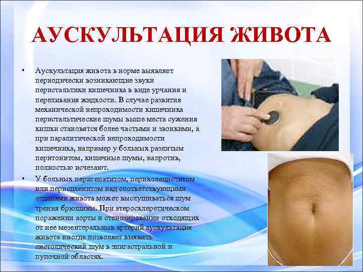 АУСКУЛЬТАЦИЯ ЖИВОТА • • Аускультация живота в норме выявляет периодически возникающие звуки перистальтики кишечника