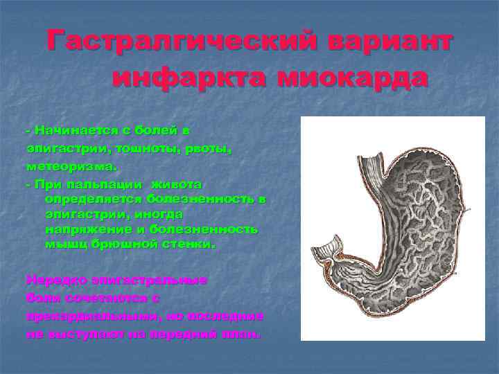 Гастралгический вариант инфаркта миокарда - Начинается с болей в эпигастрии, тошноты, рвоты, метеоризма. -