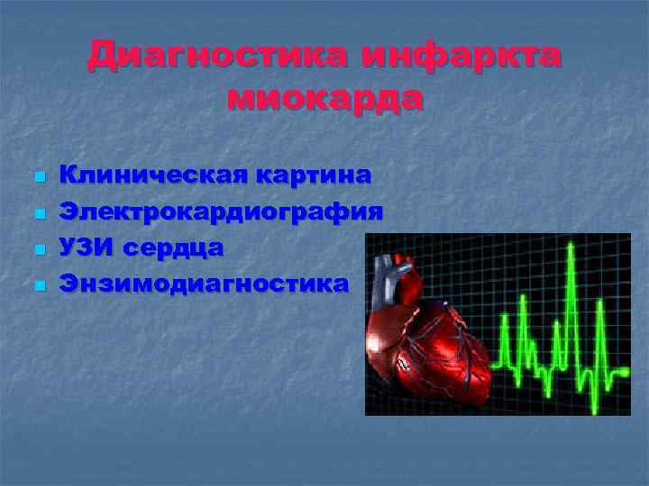 Диагностика инфаркта миокарда n n Клиническая картина Электрокардиография УЗИ сердца Энзимодиагностика 