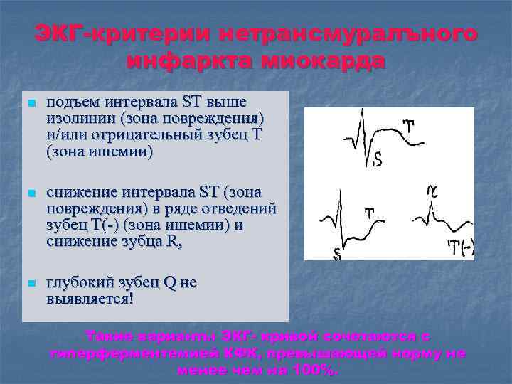 Высоко т низко. Сегмент St на ЭКГ на изолинии. St выше изолинии на ЭКГ. ЭКГ критерии инфаркта миокарда. Сегмента St выше изоэлектрической линии.