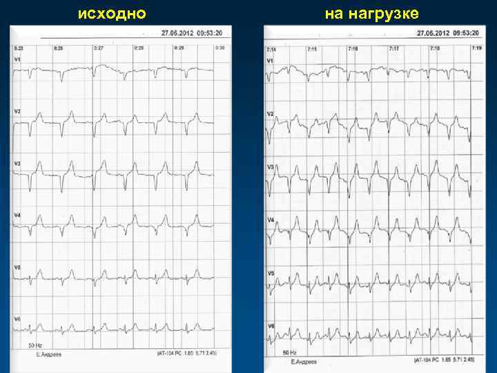 исходно на нагрузке 