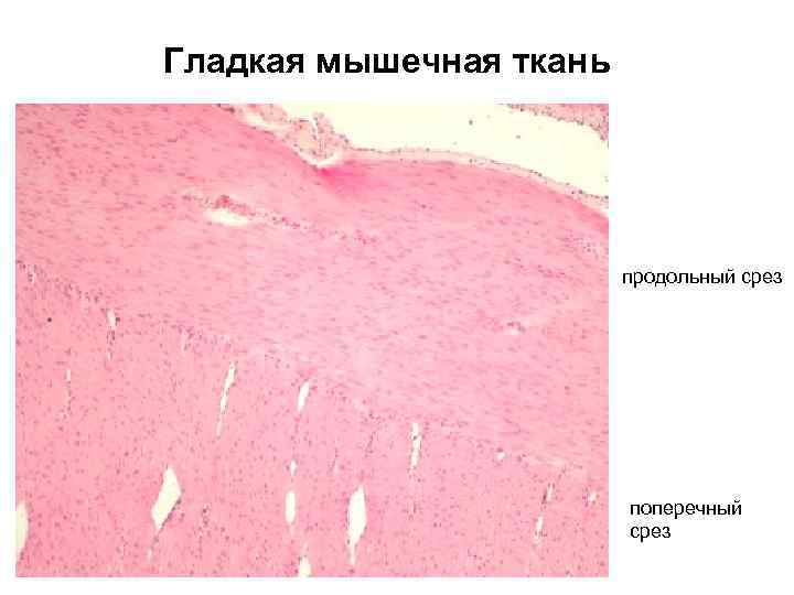 Гладкая мышечная ткань продольный срез поперечный срез 