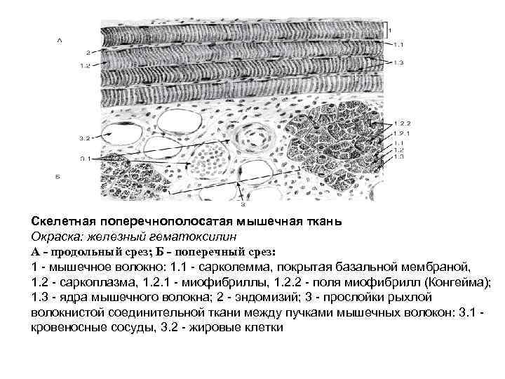 Скелетная поперечнополосатая мышечная ткань Окраска: железный гематоксилин А - продольный срез; Б - поперечный