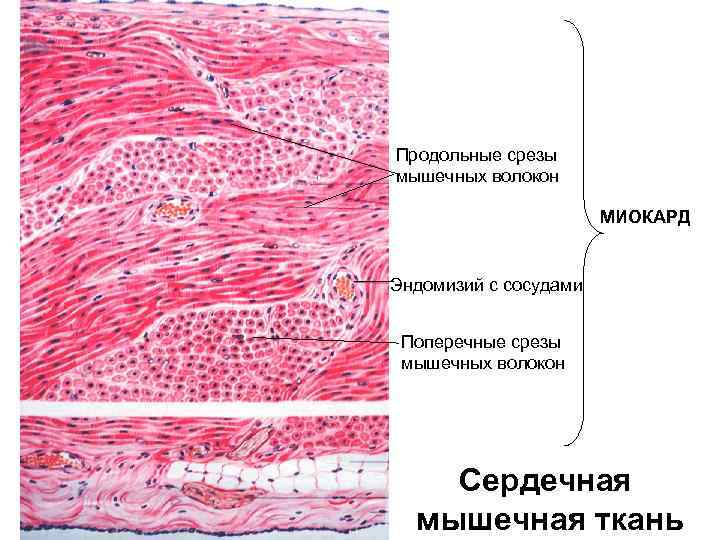 Продольные срезы мышечных волокон МИОКАРД Эндомизий с сосудами Поперечные срезы мышечных волокон Сердечная мышечная