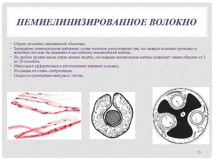 НЕМИЕЛИНИЗИРОВАННОЕ ВОЛОКНО • Серые, не имеют миелиновой оболочки. • Защищены шванновскими клетками: пучки волокон