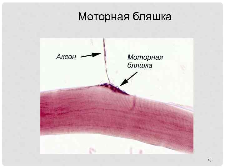 Моторная бляшка 43 