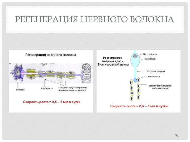 РЕГЕНЕРАЦИЯ НЕРВНОГО ВОЛОКНА 96 