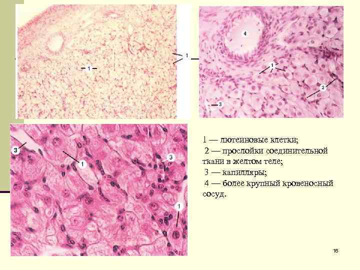 1 — лютеиновые клетки; 2 — прослойки соединительной ткани в желтом теле; 3 —