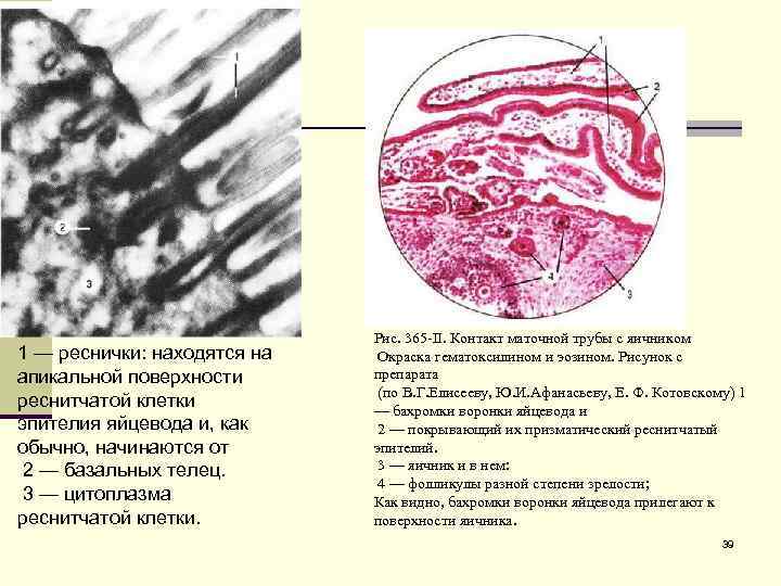 1 — реснички: находятся на апикальной поверхности реснитчатой клетки эпителия яйцевода и, как обычно,