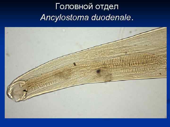 Головной отдел Ancylostoma duodenale. 