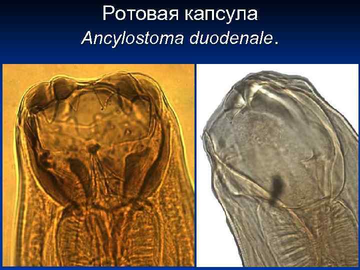 Ротовая капсула Ancylostoma duodenale. 