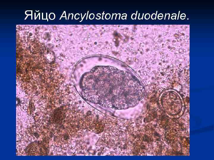 Яйцо Ancylostoma duodenale. 