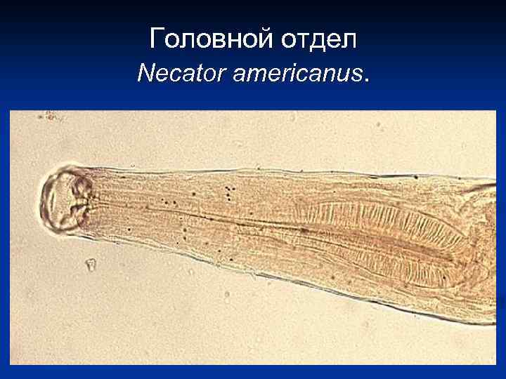 Головной отдел Necator americanus. 