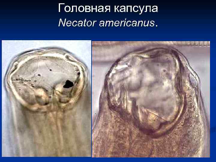 Головная капсула Necator americanus. 