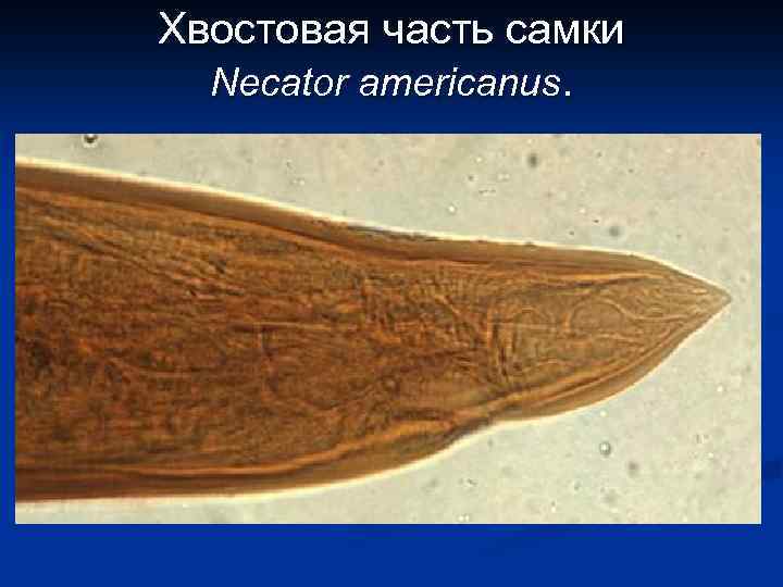 Хвостовая часть самки Necator americanus. 