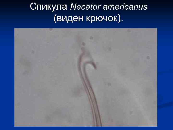 Спикула Necator americanus (виден крючок). 