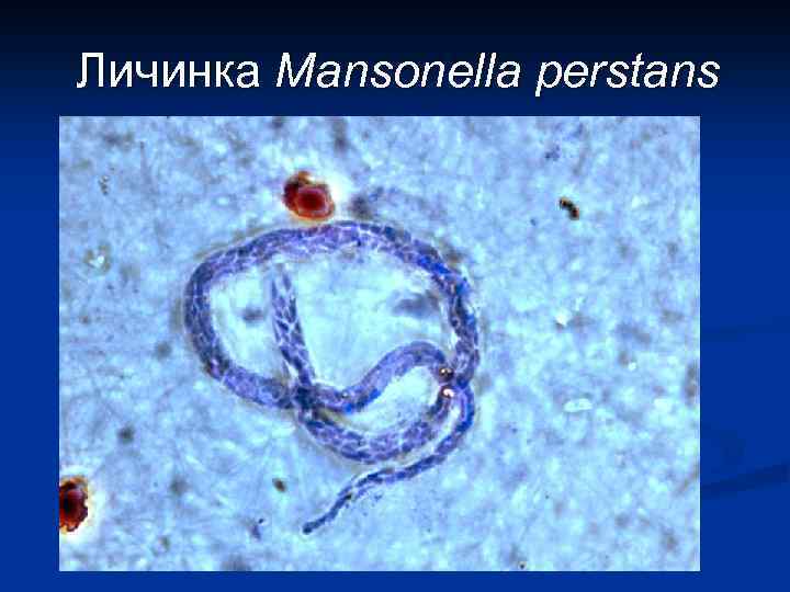 Личинка Mansonella perstans 