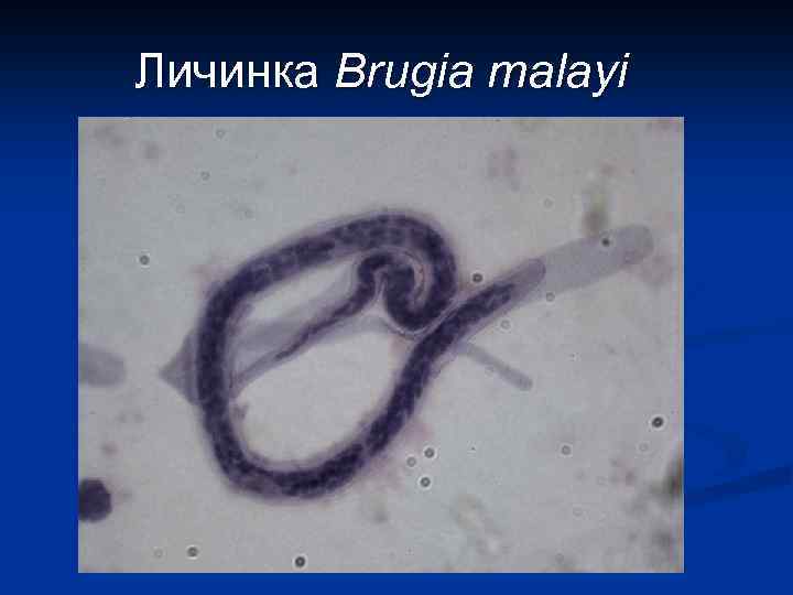 Личинка Brugia malayi 