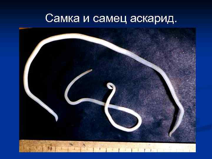 Самка и самец аскарид. 