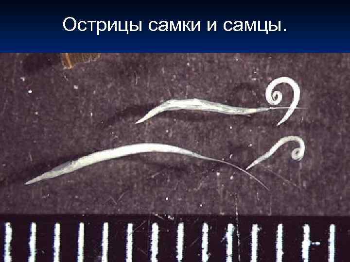 Острицы самки и самцы. 