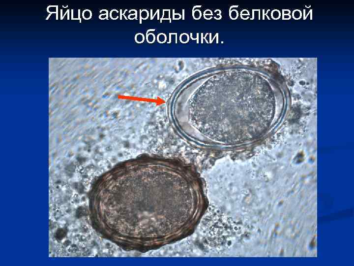 Яйцо аскариды без белковой оболочки. 