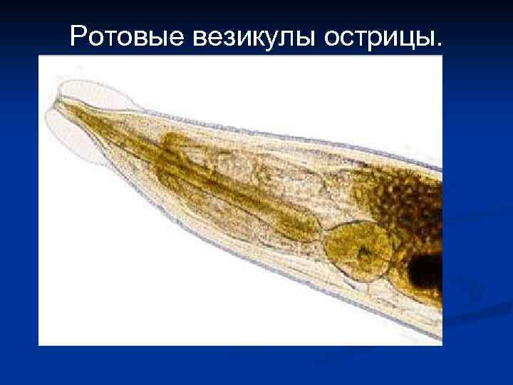 Ротовые везикулы острицы. 