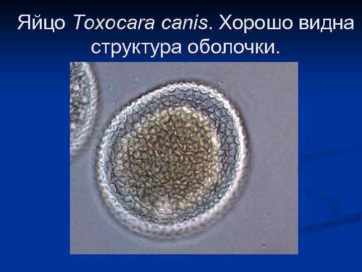 Яйцо Toxocara canis. Хорошо видна структура оболочки. 