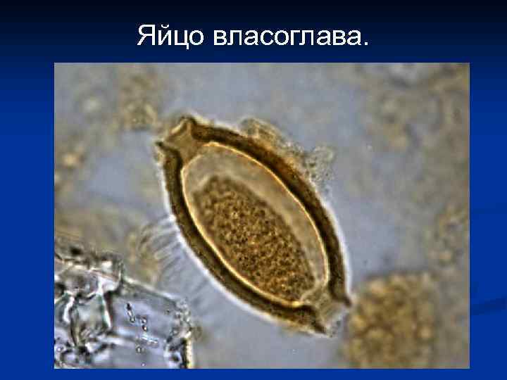 Яйцо власоглава. 
