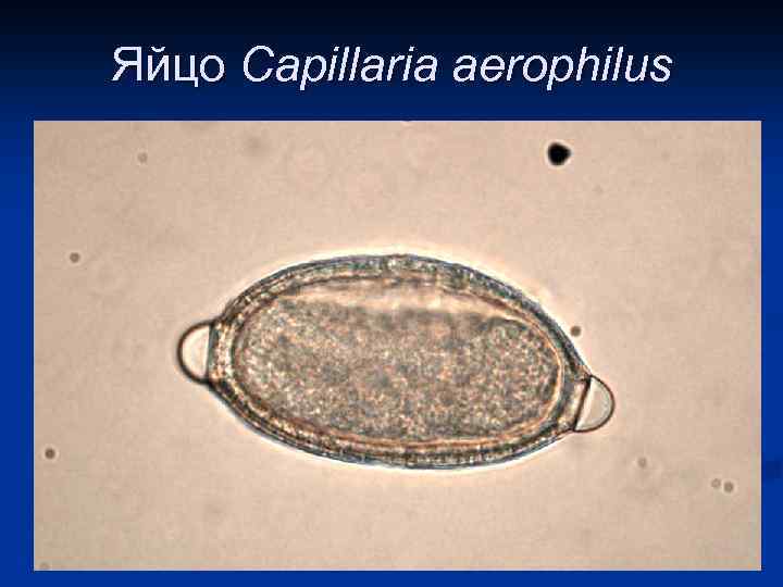 Яйцо Сapillaria aerophilus 
