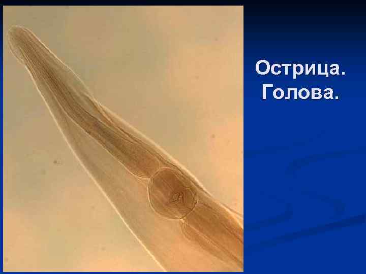 Острица. Голова. 