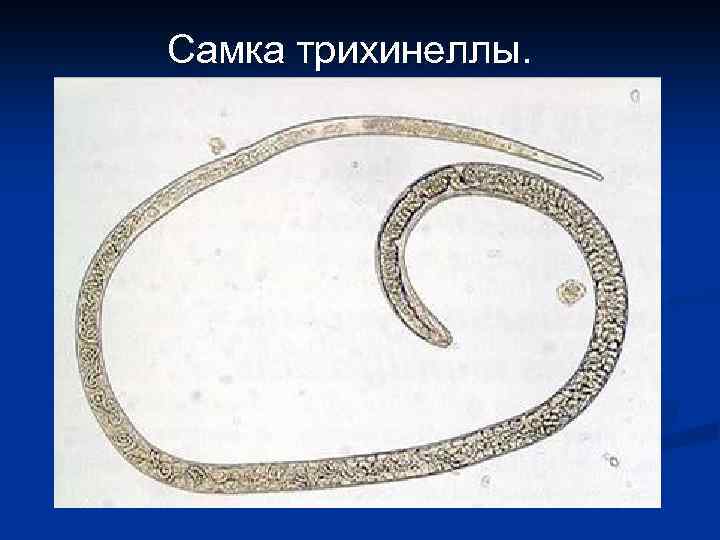 Самка трихинеллы. 