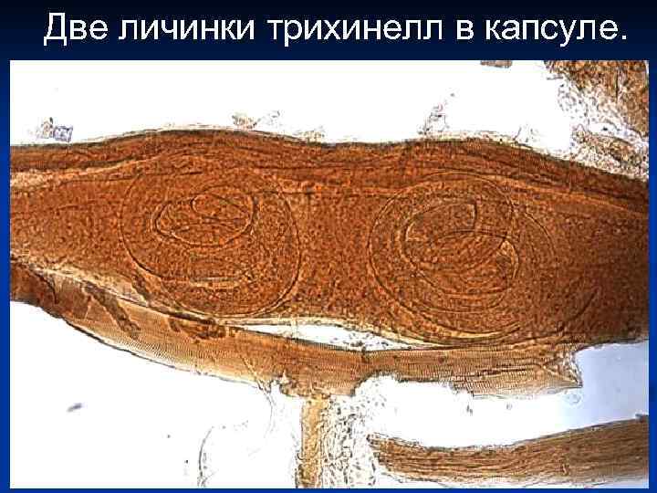 Две личинки трихинелл в капсуле. 