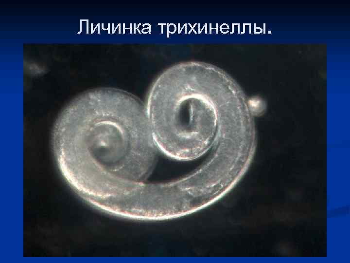 Личинка трихинеллы. 