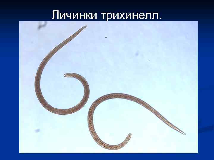 Личинки трихинелл. 