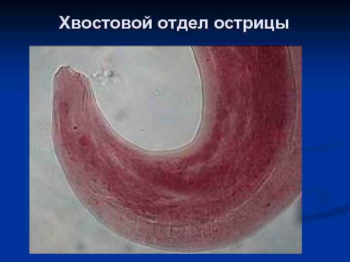 Хвостовой отдел острицы 